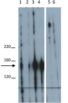 Immunoadsorption of Desmoglein-3-Specific IgG Abolishes the Blister-Inducing Capacity of Pemphigus Vulgaris IgG in Neonatal Mice